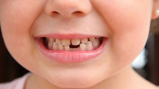 2-18 насны хүүхдүүдийн шүдийг эмчилнэ